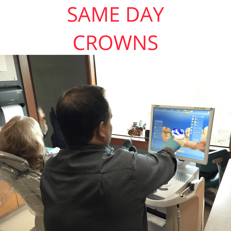 Same day crown